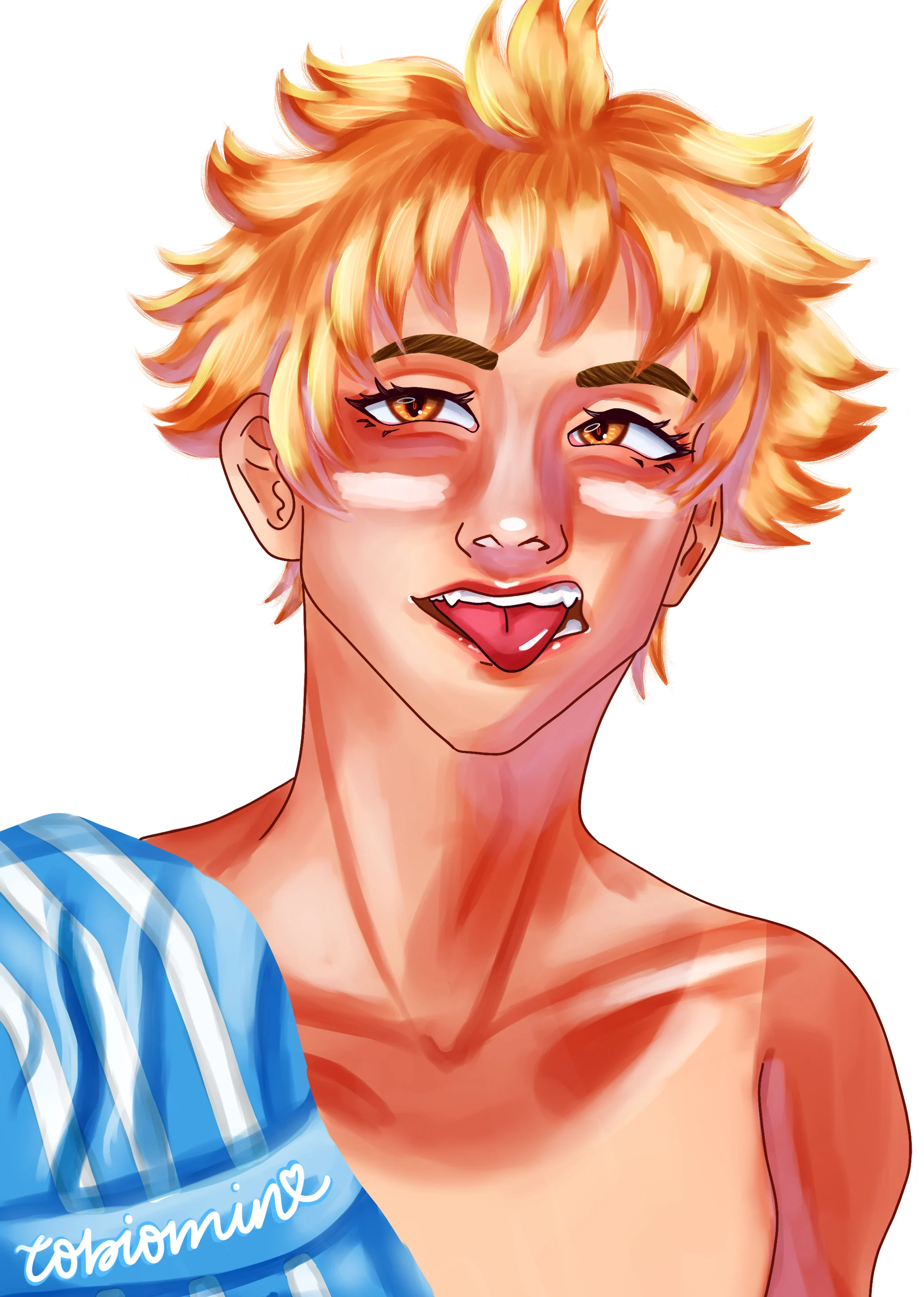 Hinata Sunburn